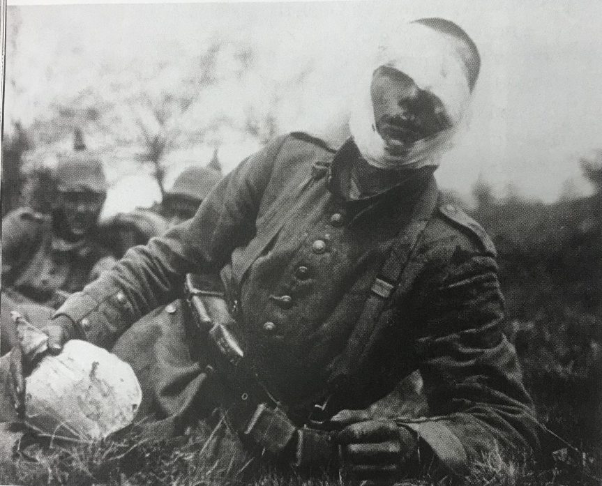 The U.S. Army Took&nbsp;Action